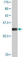 Anti-GDAP1 Mouse Polyclonal Antibody