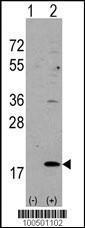 Anti-HPCAL1 Rabbit Polyclonal Antibody (AP (Alkaline Phosphatase))