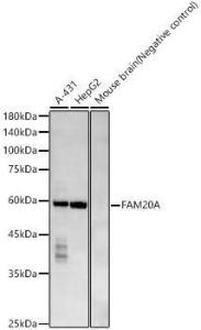 Western blot analysis of various lysates, using Anti-FAM20A Antibody [ARC58698] (A309801) at 1:20,000 dilution The secondary antibody was Goat Anti-Rabbit IgG H&L Antibody (HRP) at 1:10,000 dilution Lysates/proteins were present at 25 µg per lane