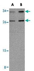 Anti-NIPSNAP3A Rabbit Polyclonal Antibody