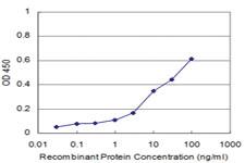 Anti-TIE1 Mouse Monoclonal Antibody [clone: 3F4]