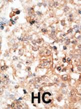 Anti-Osteocalcin Rabbit Polyclonal Antibody