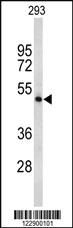 Anti-TPH2 Rabbit Polyclonal Antibody