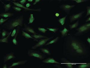 Anti-PRKCD Mouse Monoclonal Antibody [clone: 8E12]