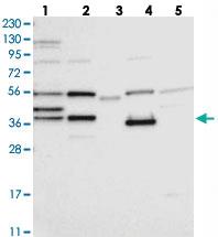 Anti-ZCWPW2 Rabbit Polyclonal Antibody