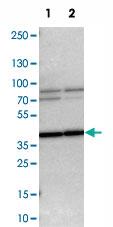 Anti-WBSCR17 Rabbit Polyclonal Antibody