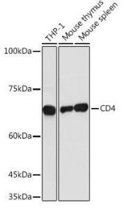 Western blot analysis of extracts of various cell lines, using Anti-CD4 Antibody (A11458) at 1:1000 dilution