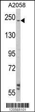 Anti-LAMB2 Rabbit Polyclonal Antibody