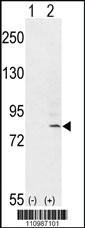 Anti-FGFR1 Rabbit Polyclonal Antibody