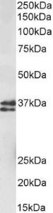 Antibody anti-MSI2 A82621-100 100 µg