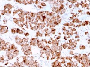 Immunohistochemical analysis of formalin-fixed, paraffin-embedded human pituitary using Anti-Growth Hormone Antibody [GH/3155]