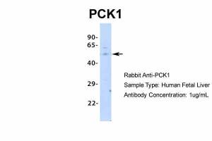 Anti-PCK1 Rabbit Polyclonal Antibody