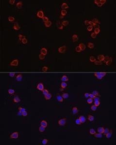 Immunofluorescence analysis of Jurkat cells using Anti-CD4 Antibody (A11458) at a dilution of 1:100 (40x lens). DAPI was used to stain the cell nuclei (blue)