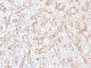 Anti-TNFS15 antibody