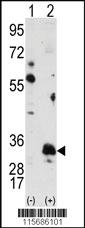 Anti-PIM1 Rabbit Polyclonal Antibody