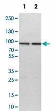 Anti-HSPA12B Rabbit Polyclonal Antibody