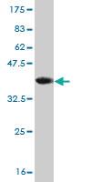 Anti-DAZ1 Mouse Monoclonal Antibody [clone: 3E3]