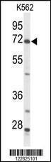 Anti-ACSS2 Rabbit Polyclonal Antibody (HRP (Horseradish Peroxidase))