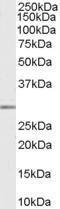 Anti-MMP7 Antibody (A84120) (0.03µg/ml) staining of Human Breast lysate (35µg protein in RIPA buffer). Primary incubation was 1 hour. Detected by chemiluminescence.