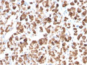 Immunohistochemical analysis of formalin-fixed, paraffin-embedded human pituitary using Anti-Growth Hormone Antibody [GH/3155]