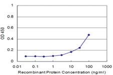 Anti-TIE1 Mouse Monoclonal Antibody [clone: 2G11]