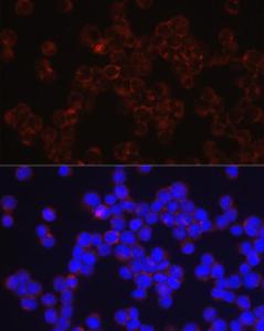 Immunofluorescence analysis of K-562 cells using Anti-CD4 Antibody (A11458) at a dilution of 1:100 (40x lens). DAPI was used to stain the cell nuclei (blue)