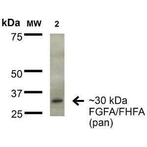 Western blot analysis of rat brain membrane showing detection of ~30 kDa FGFA/FHFA (pan) protein using Anti-FGF13 Antibody [S235-22] (A304756) at 1:200 for 16 hours at 4°C Lane 1: Molecular Weight Ladder Lane 2: rat brain Membrane Load: 15  µg Block: 2% BSA and 2% Skim Milk in 1X TBST