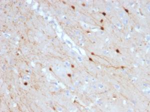 Anti-Calretinin Mouse Monoclonal Antibody [clone: CALB2/2685]