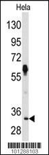 Anti-PIM2 Rabbit Polyclonal Antibody