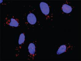 Anti-SMARCB1 + BAZ1B Antibody Pair