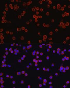 Immunofluorescence analysis of RAW264. 7 cells using Anti-CD4 Antibody (A11458) at a dilution of 1:100 (40x lens). DAPI was used to stain the cell nuclei (blue)