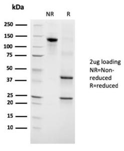 SDS-PAGE analysis of Anti-Growth Hormone Antibody [GH/3155] under non-reduced and reduced conditions; showing intact IgG and intact heavy and light chains, respectively. SDS-PAGE analysis confirms the integrity and purity of the antibody.