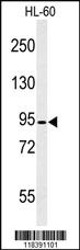 Anti-CAPN3 Rabbit Polyclonal Antibody