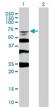 Anti-RMI1 Mouse Polyclonal Antibody