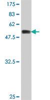 Anti-AKTIP Mouse Polyclonal Antibody