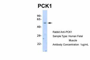 Anti-PCK1 Rabbit Polyclonal Antibody