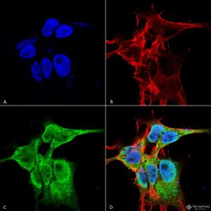 Immunocytochemistry/Immunofluorescence analysis of human neuroblastoma cell line (SK-N-BE, fixed in 4% formaldehyde for 15 min at room temperature, using Anti-FGF13 Antibody [S235-22] (A304756), at 1:100 for 60 minutes at room temperature