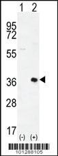 Anti-PIM2 Rabbit Polyclonal Antibody