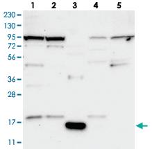 Anti-ANAPC16 Rabbit Polyclonal Antibody