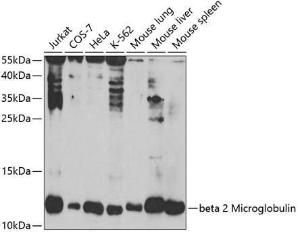 Western blot analysis of extracts of various cell lines, using Anti-beta 2 Microglobulin Antibody (A11459) at 1:1,000 dilution