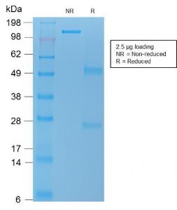 Anti-TNFS15 antibody