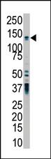 Anti-Protein Kinase D2 (PKC-D2) Rabbit Polyclonal Antibody