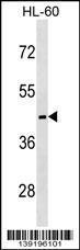 Anti-MC5R Rabbit Polyclonal Antibody (HRP (Horseradish Peroxidase))