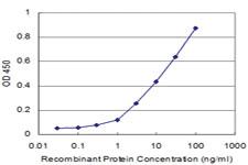 Anti-PRKCD Mouse Monoclonal Antibody [clone: 8E12]