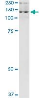 Anti-ADAR Polyclonal Antibody Pair