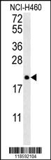 Anti-PTP4A2 Rabbit Polyclonal Antibody