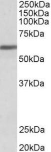 Anti-ZNF703 Antibody (A84122) (1µg/ml) staining of Human Breast cancer lysate (35µg protein in RIPA buffer). Primary incubation was 1 hour. Detected by chemiluminescence.