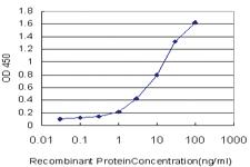 Anti-MCCC1 Mouse Monoclonal Antibody [clone: 2G8]