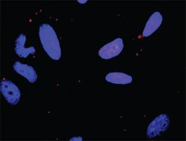 Anti-MAPK8 + FASLG Antibody Pair