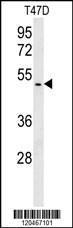 Anti-BABAM1 Rabbit Polyclonal Antibody (HRP (Horseradish Peroxidase))